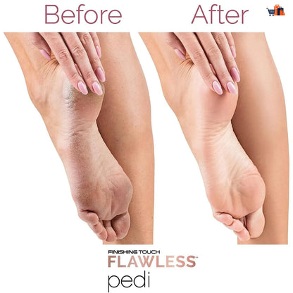 Electric Foot Callus Remover for Feet - Foot Scrubber for Dead Skin - Rechargeable Pedicure Tool Callus Remover for Feet Electronic Foot File - Feet Care for Removes Dry Hard and Dead Skin Ideal Gift